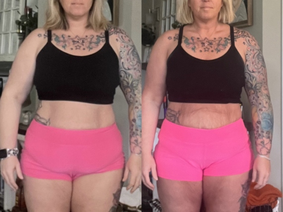 yu trimfit before and after pictures 2
